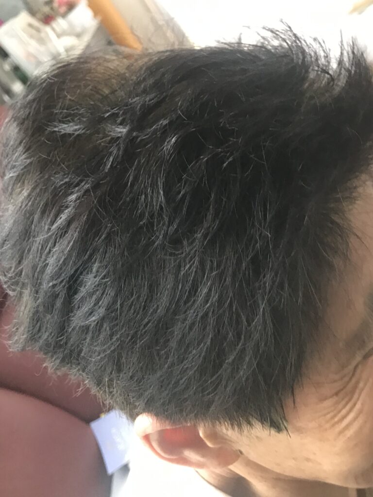 ヘナ染め後のフロント